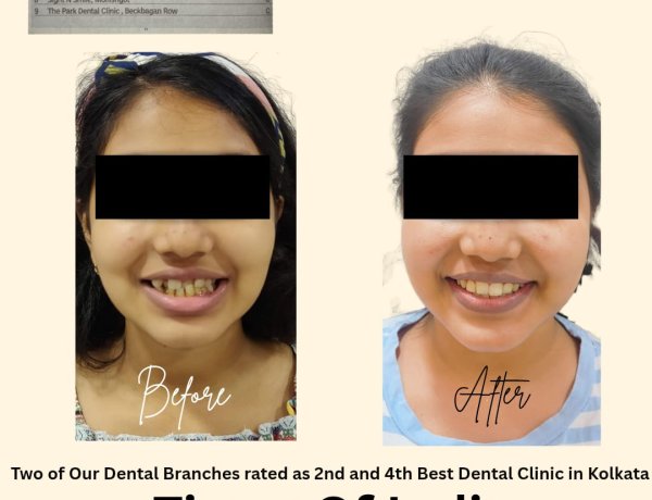 Teeth Care Multispeciality Dental Clinic Being the Best Dental Braces Center in Kolkata